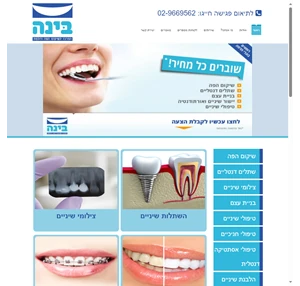 רופא שיניים בירושלים מרפאת שיניים בירושלים בינה - המרכז לשיקום הפה והלסת